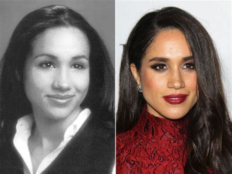 Meghan Markle, Before and After | The Skincare Edit | Meghan markle ...