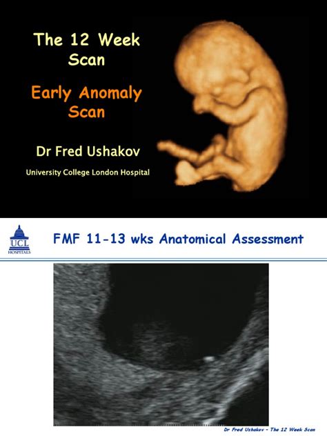 Early Pregnancy Anomaly Scan | Congenital Disorder | Children's Health