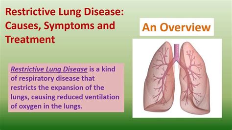 All About Restrictive Lung Disease - Hoool.com - YouTube | Lung disease ...