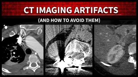 Imaging Artifacts – 3D and Quantitative Imaging Laboratory