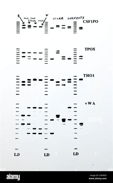 Forensic DNA results with STR analysis of samples Stock Photo - Alamy