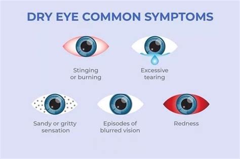 Eye Drops For Dry Eyes | Advanced Eye Clinic