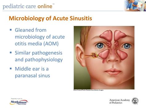 PPT - Diagnosis and Management of Acute Bacterial Sinusitis: 2013 AAP Guideline Ellen R. Wald ...