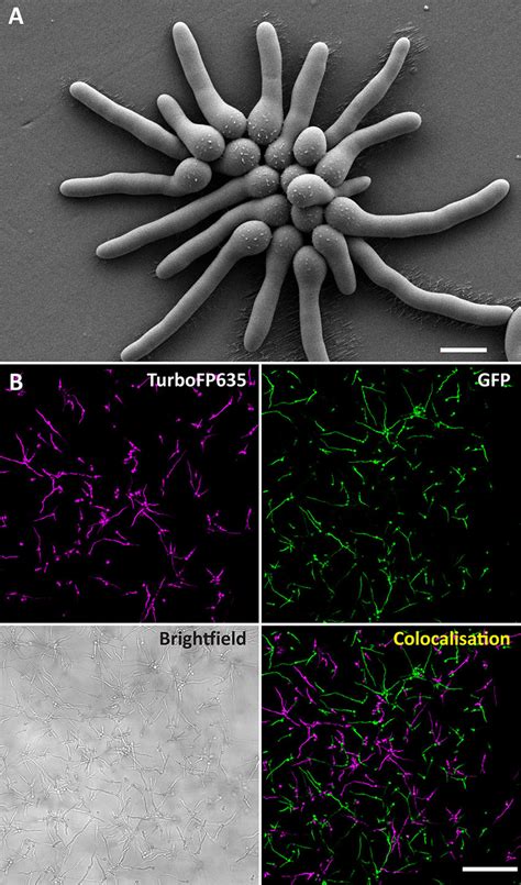 Cell fusion was not observed in strain AF293 on solid culture, or in... | Download Scientific ...