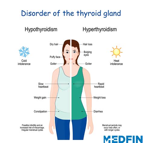 Thyroid: Frequently Asked Questions - Medfin