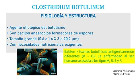 Clostridium Botulinum | MAXY AGUILAR | uDocz