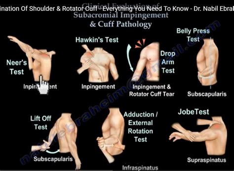 Shoulder Internal Rotation Manual Muscle Test