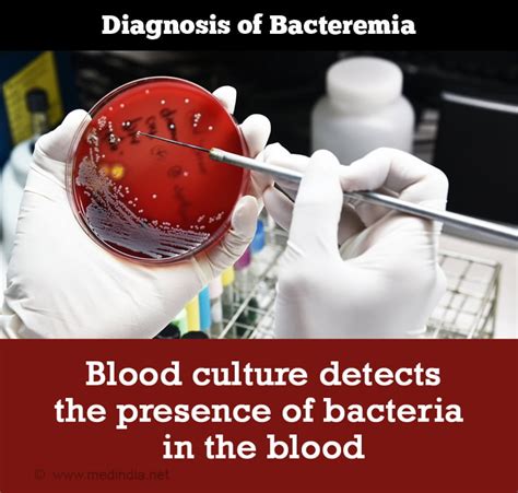 Bacteremia - Causes, Symptoms, Diagnosis, Treatment, Prevention