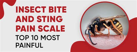 Insect Bite & Sting Pain Scale: Top 10 Most Painful – Dr. Numb®