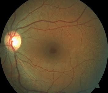 Retinal Review: January 2024 - OOMC