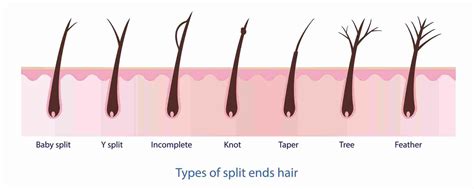 What Causes Split Ends | Expert Reveals Top 8 Reasons For Hair Damage! - Hair Everyday Review