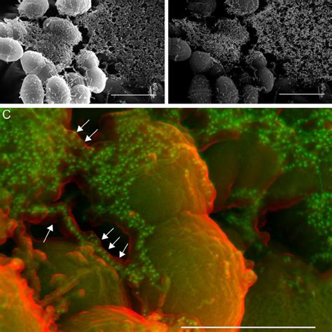 (PDF) Enterococcus faecalis Produces Abundant Extracellular Structures ...