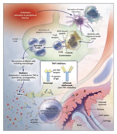 Tumor Necrosis Factor Inhibitors for Rheumatoid Arthritis | NEJM