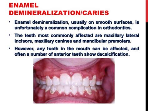 Risks in orthodontic treatment