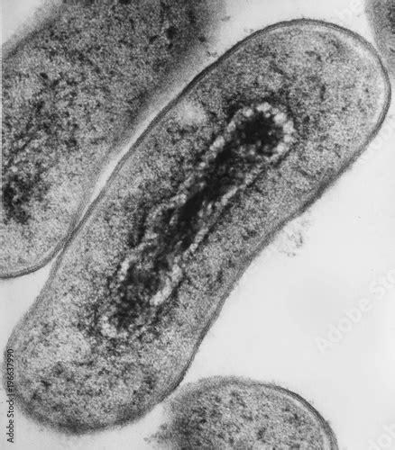 "Cross section of Escherichia coli bacteria under transmission electron ...