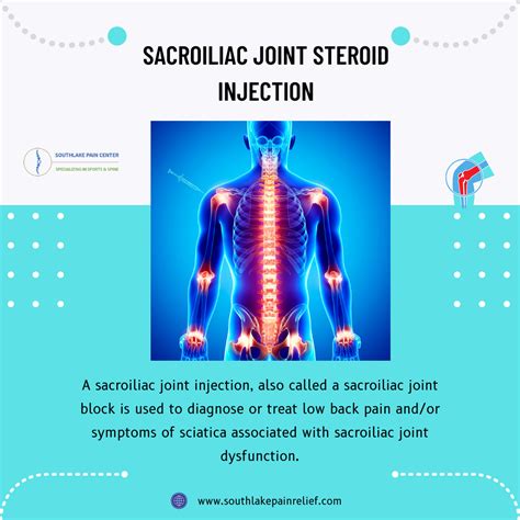 Sacroiliac Joint Steroid Injection : Procedure – South Lake Pain Center – Pain Management ...