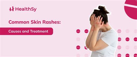 Common Skin Rashes: Causes and Treatment - HealthSy Article