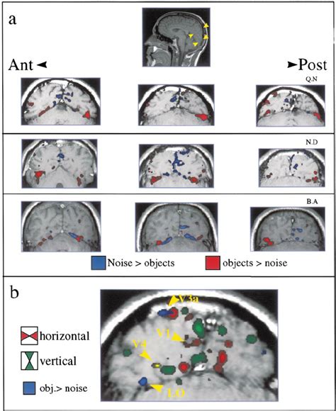 Adaptation-Duration Experiment: Localization of Object- and... | Download Scientific Diagram