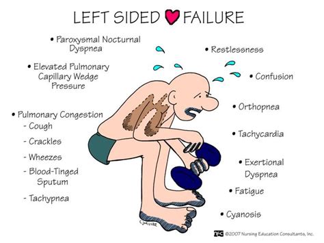 Left sided heart failure I always use this slide when I teach heart failure to my nurses, it ...