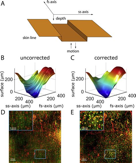 Raster-Scanning Optoacoustic Mesoscopy for Gastrointestinal Imaging at High Resolution ...