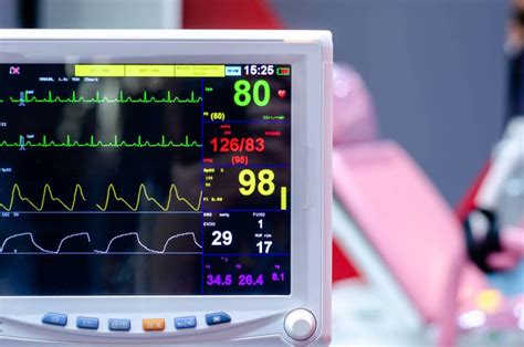 End-Tidal CO2 Monitoring During Anesthesia - Radius Anesthesia of Georgia