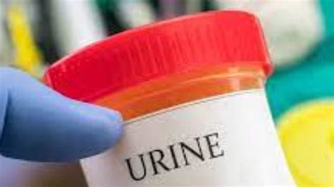 Protein In Urine Is A Sign Of Kidney Damage; Check Symptoms, Causes And Treatment - Divya Bharat 🇮🇳