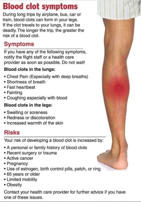 The Dangers of Deep Vein Thrombosis - Almawi Limited The Holistic Clinic