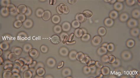 Red blood cells under the microscope, hypo and hypertonic solutions - YouTube