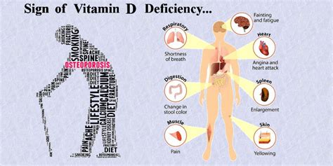 Can Low Levels of Vitamin D Cause Serious Health Concerns?