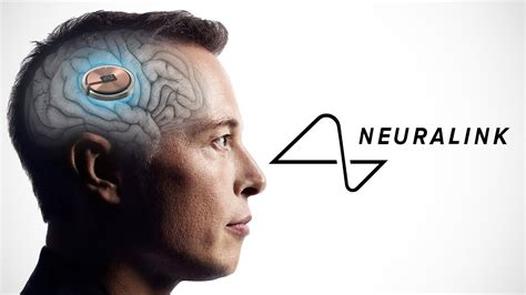 Neuralink: Elon Musk's Vision for a Brain-Computer Interface