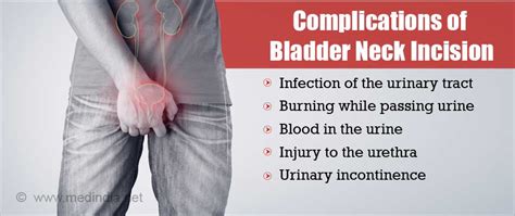 Bladder Neck Incision - Indications, Types and Complications