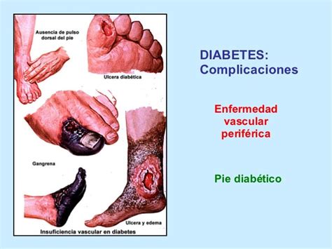 ÍNDICE DE MORTALIDAD A CAUSA DE LA DIABETES.