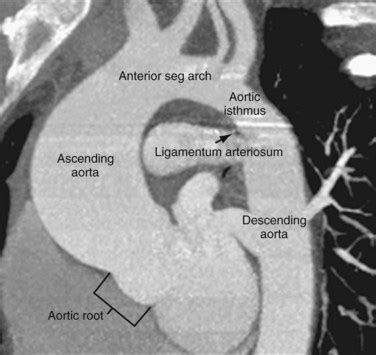 Arterial Anatomy of the Thorax | Radiology Key