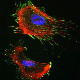 Conjugated Secondary Antibodies - Drug Discovery and Development