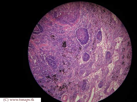 Histology Slides Database: lymph node histology slide