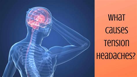 What Causes Tension Headaches? | Ear Nose & Throat Consultants, LLC