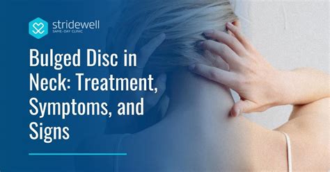 Bulged Disc in Neck: Treatment, Symptoms, and Signs - Stridewell