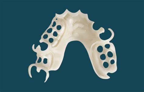 Digital Partial Denture Design: Acetal Resin, Wironium, and Titanium