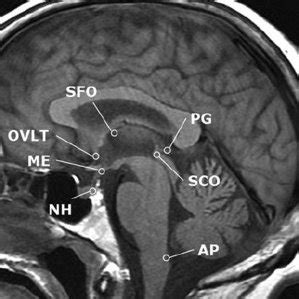 Mid-sagittal MRI showing positions of the CVO. NH, neurohypophysis, ME ...