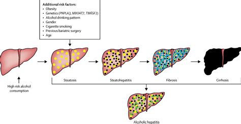 Outpatient management of alcohol-related liver disease - The Lancet ...