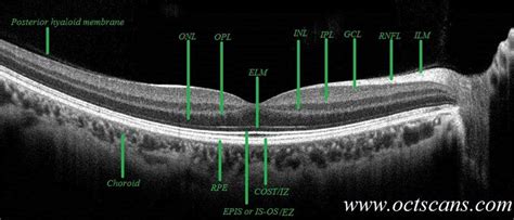 Anatomy Review - Optical Coherence Tomography Scans