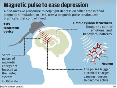 TMS - Transcranial Magnetic Stimulation Therapy - Williamsville Psychiatry