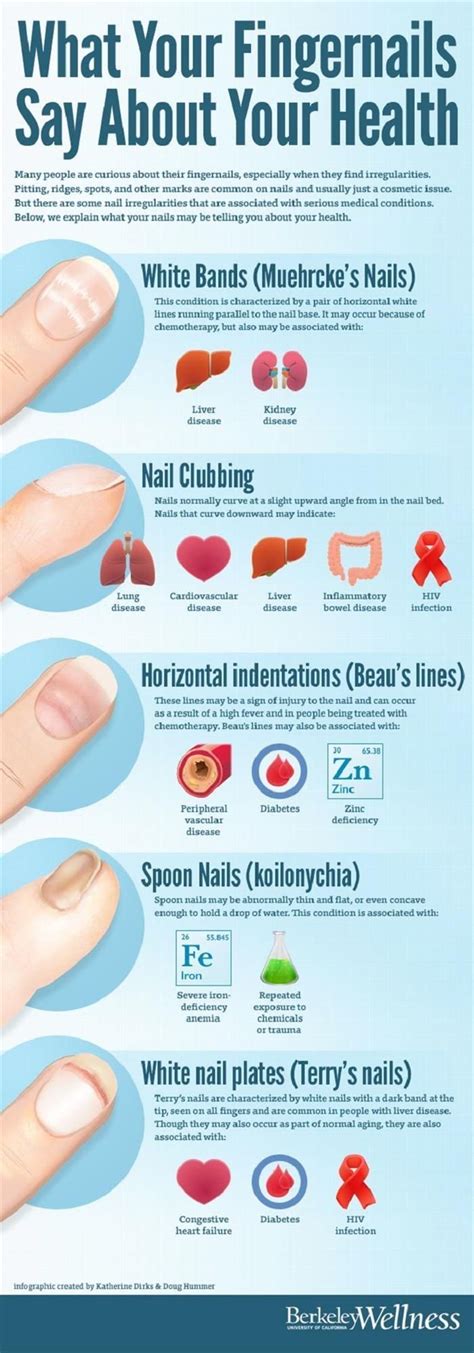 What Your Fingernails Say About Your Health | Fingernail health, Health remedies, Health tips