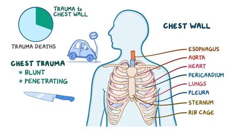 Signs and Symptoms of Flail Chest Include