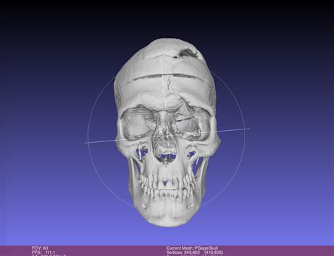 Phineas Gage Skull, harvard CT SCAN, Museum Quality High Resolution STL // 3D Printing - Etsy