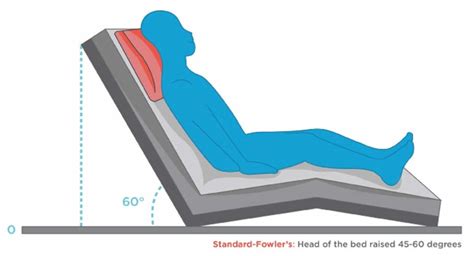 Fowler’s position, uses for Fowler’s position