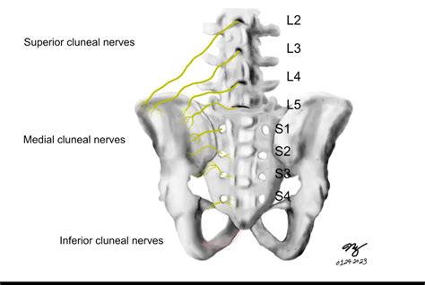 Does Cluneal Nerve Entrapment Cause Back Pain? - Massage & Fitness Magazine