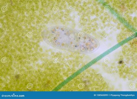 Frontonia Sp. Unicellular Ciliate Protists Under the Microscope. Stock Image - Image of ciliate ...