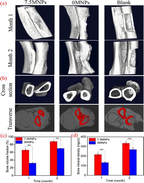 Micro-CT analysis of new bone formation in bone defect treated with... | Download Scientific Diagram