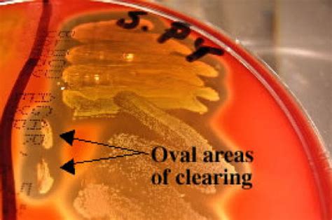 Blood Agar Plates | Summary of Biochemical Tests | Additional Info ...